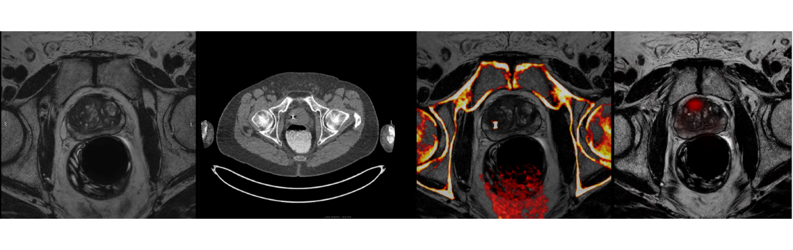 Medical Imageing